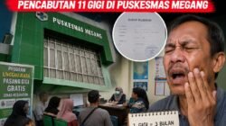 Program Gigi Gratis Dipertanyakan, Pasien Keluhkan Mekanisme Pencabutan 11 Gigi di Puskesmas Megang